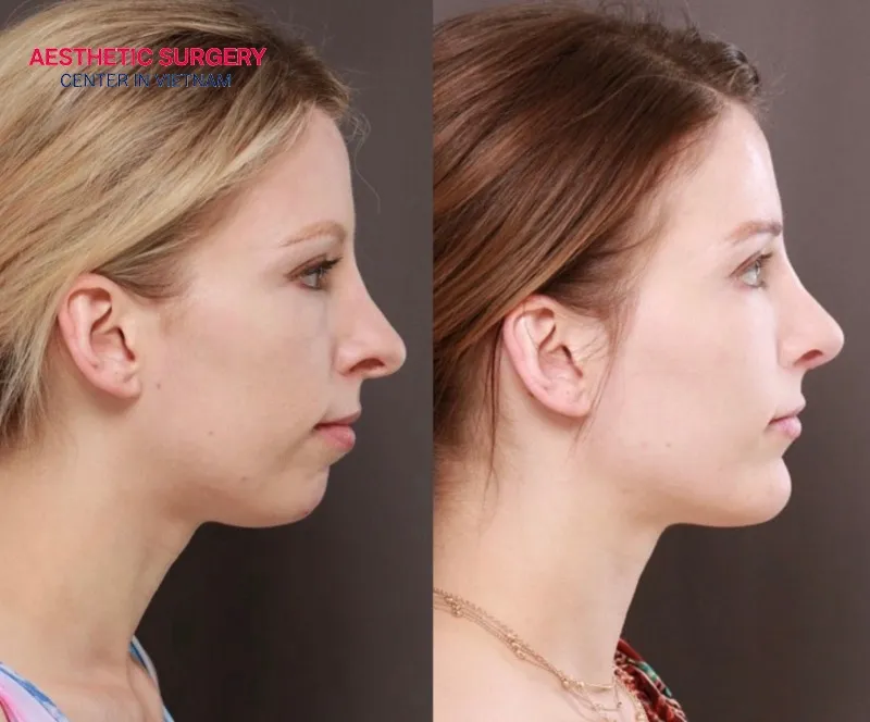 Just a small change can make a noticeable difference.