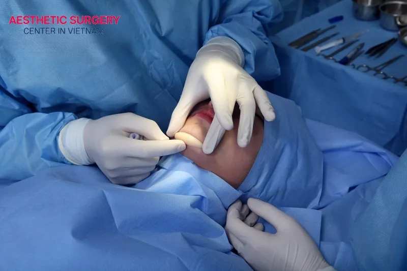 Aesthetic Surgery Center is a trusted beauty destination in Vietnam.