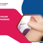 Chin filler contouring