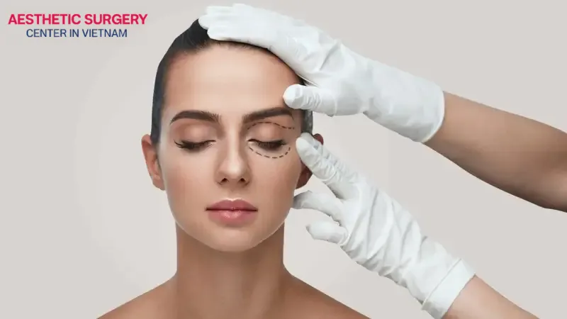 The eyelid cosmetic method depends on the condition of your eyelids.