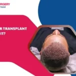 Is a hair transplant worth