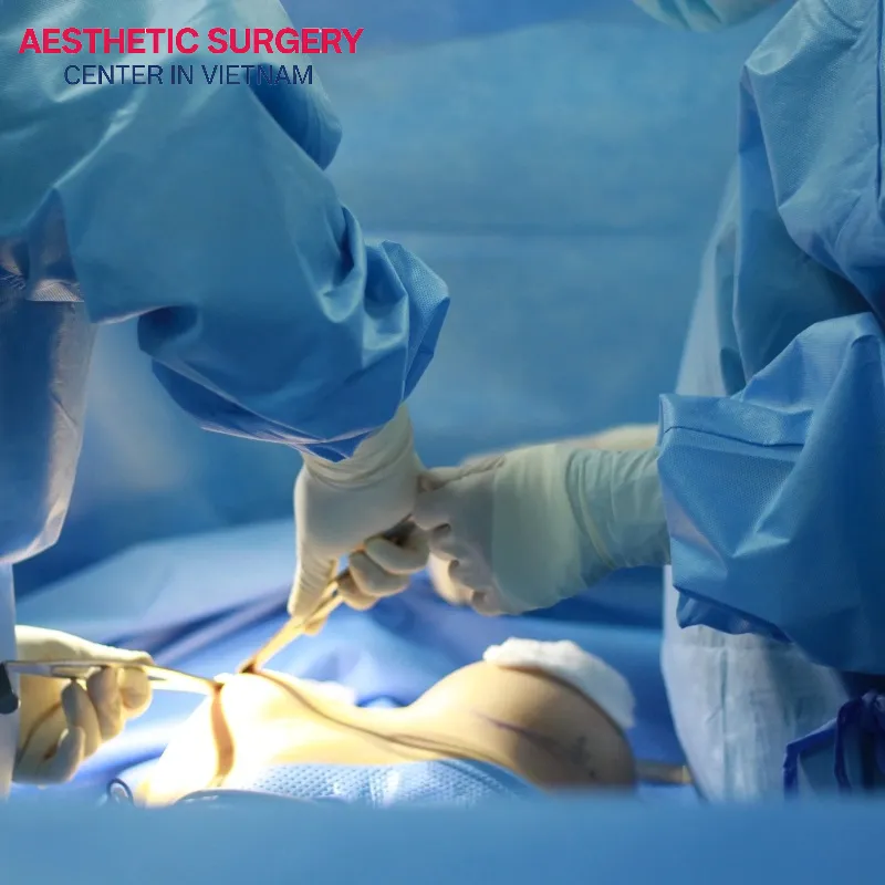 Choosing a reputable surgeon is one of the most essential factors to consider in breast augmentation treatment