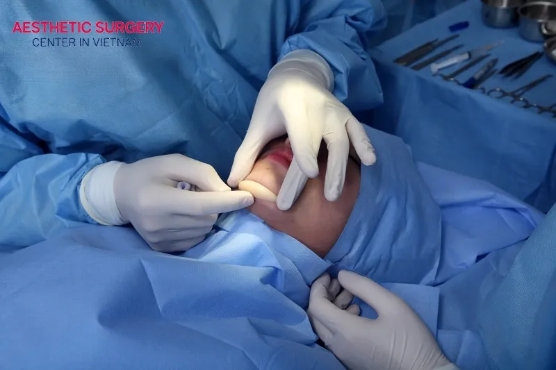 The mandibular angle reduction surgery process is performed according to strict medical standards.