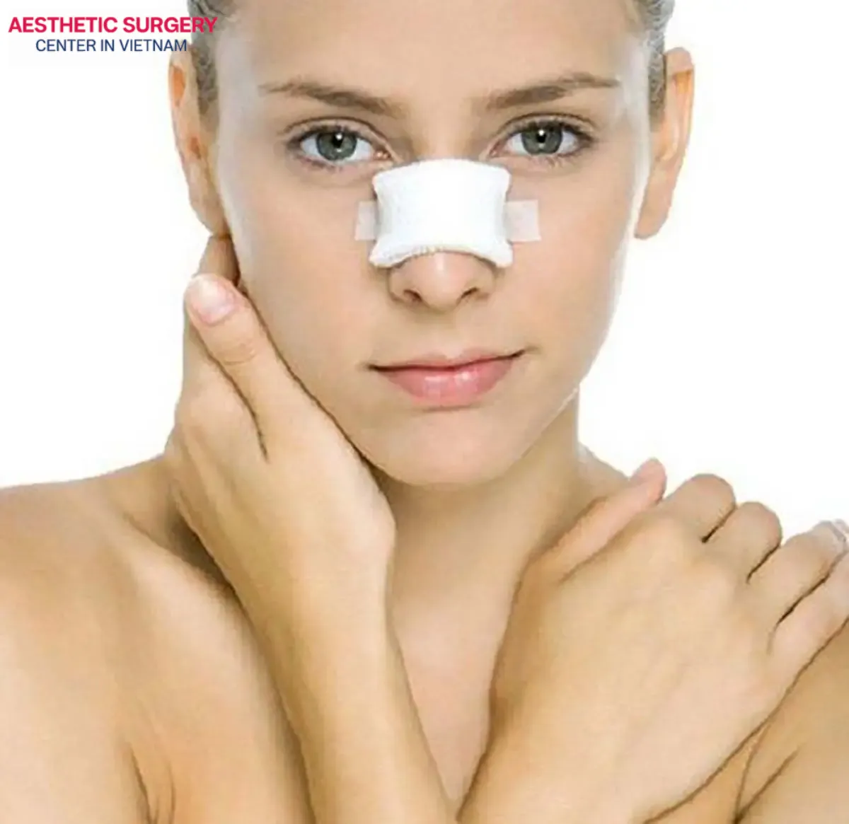 In most Rhinoplasty cases, surgeons recommend nose taping to help stabilize the nose shape and maintain long-lasting results
