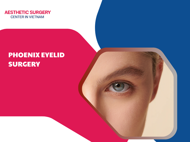 phoenix eyelid surgery