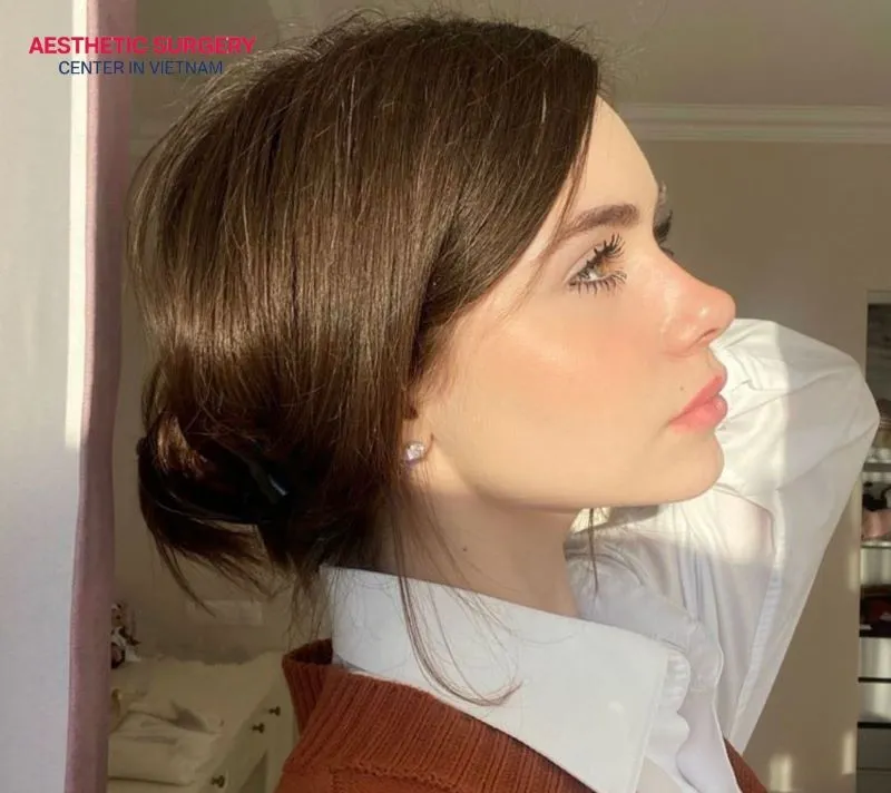 Enhancing the client’s appearance after full recovery, the refined nose shape provides long-lasting beauty.