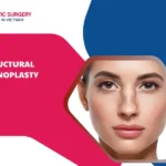 structural rhinoplasty