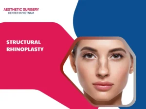 structural rhinoplasty