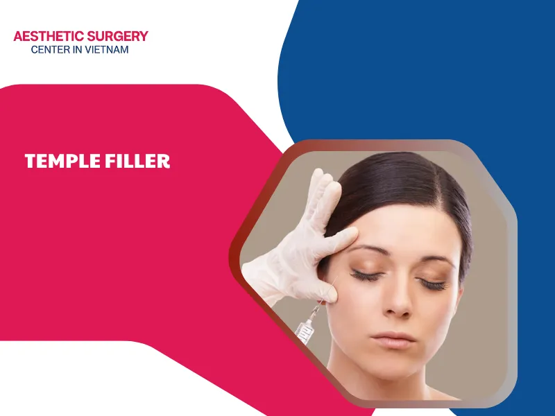 Temple filler