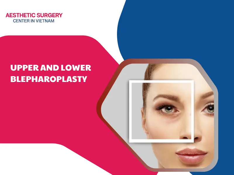 Upper and lower blepharoplasty