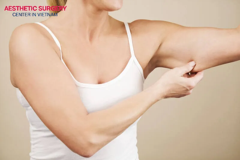 Upper arm Liposuction can cause the skin to sag if it lacks good elasticity