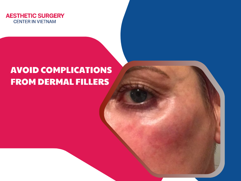 avoid-complications-from-dermal-fillers