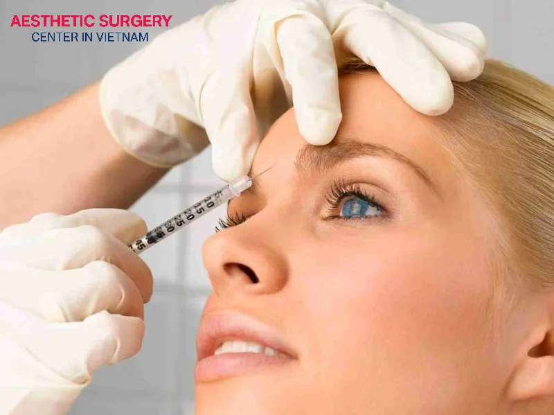 Botox injections still allow facial expressions to be maintained, contrary to the common belief that they cause stiffness.