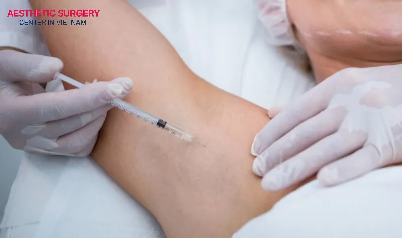 Botox injections can help reduce sweating.