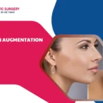 Chin augmentation surgery