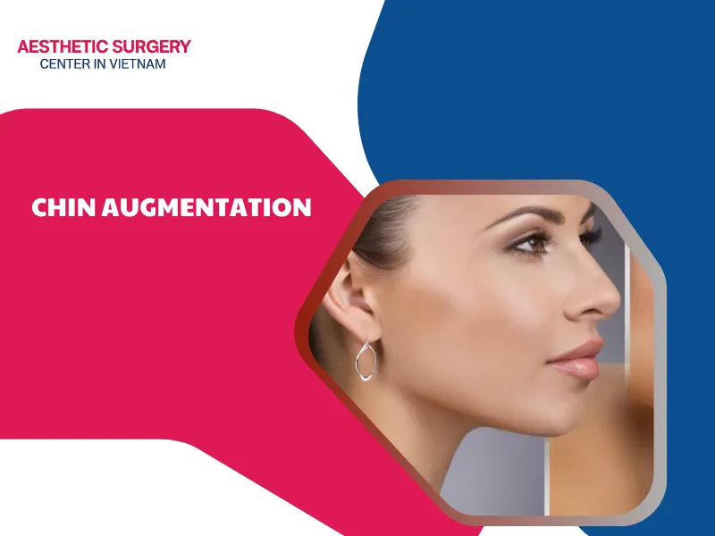 Chin augmentation surgery