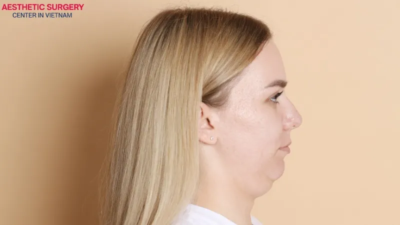 Individuals with a short, receding, or unbalanced chin are ideal candidates for this procedure.