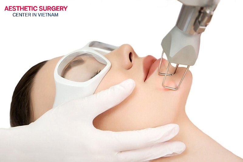 The fractional CO2 laser resurfacing method helps treat various skin concerns such as pigmentation, dark spots, and uneven skin tone.