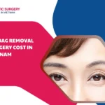 Eyebag removal surgery cost in vietnam