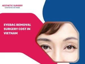 Eyebag removal surgery cost in vietnam