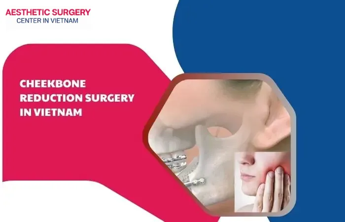 Cheekbone reduction surgery in vietnam