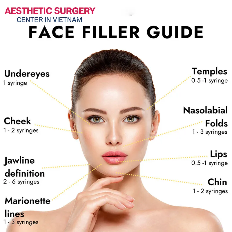 Each facial area requires a customized amount of filler, directly affecting pricing