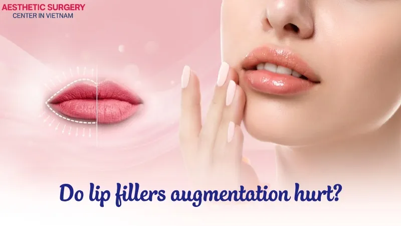 Lip filler augmentation is virtually painless and completely tolerable.