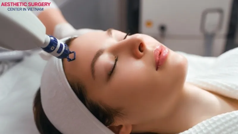 Laser pore size refinement treatment – a modern and popular skincare method.