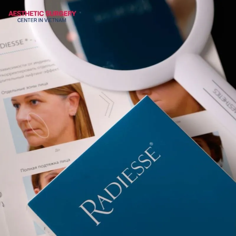 Some types of fillers are commonly used for their effective volumizing ability in the temple area, smile lines and other parts of the body.