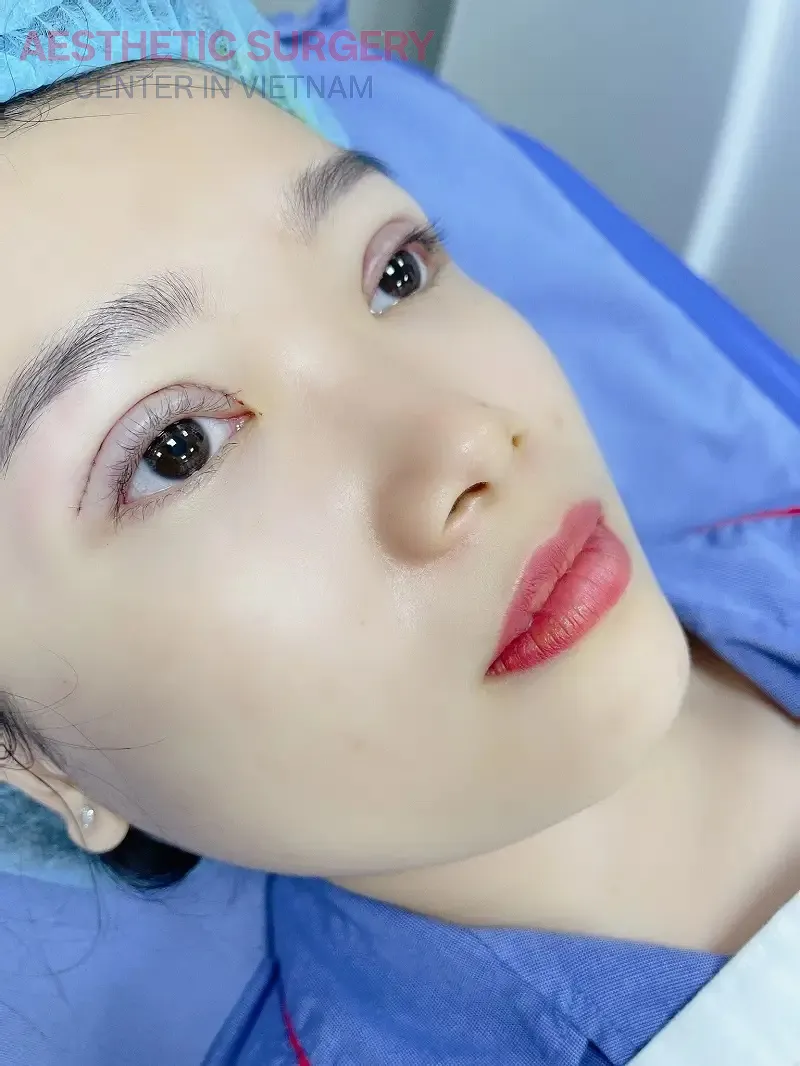 You may encounter some side effects or risks if the surgery is performed at an unreliable clinic.