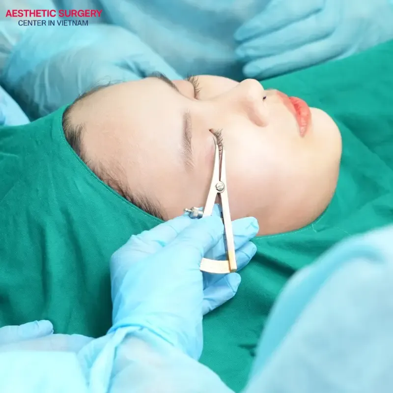 The suitable age for eyelid surgery is from 18 years and older.