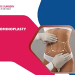 Abdominoplasty