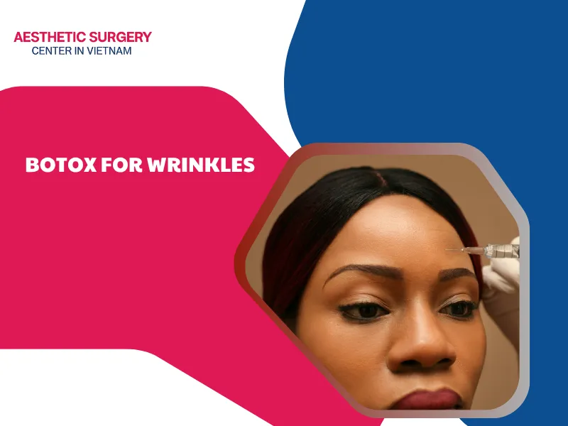 Botox for Wrinkles