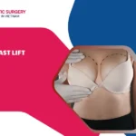 Breast Lift