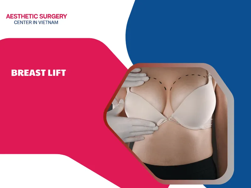 Breast Lift