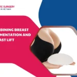 Combining breast augmentation and breast lift