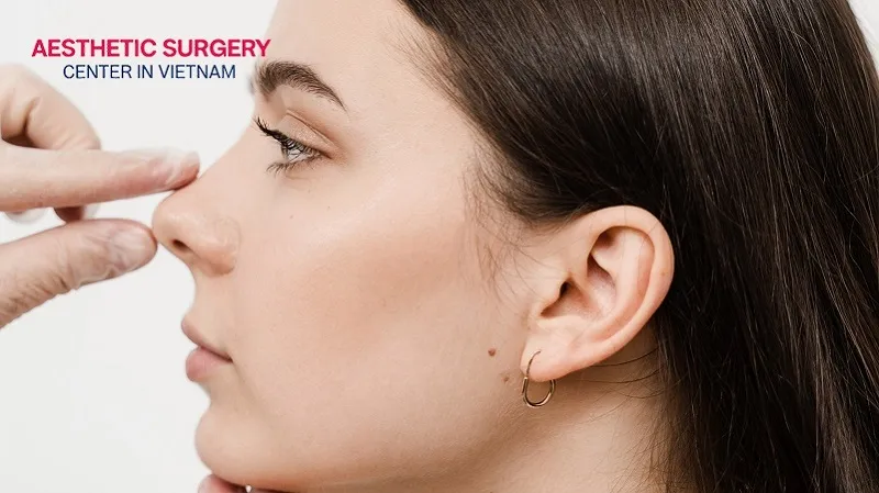 Ear cartilage rhinoplasty uses autologous conchal cartilage taken from the ear rim.