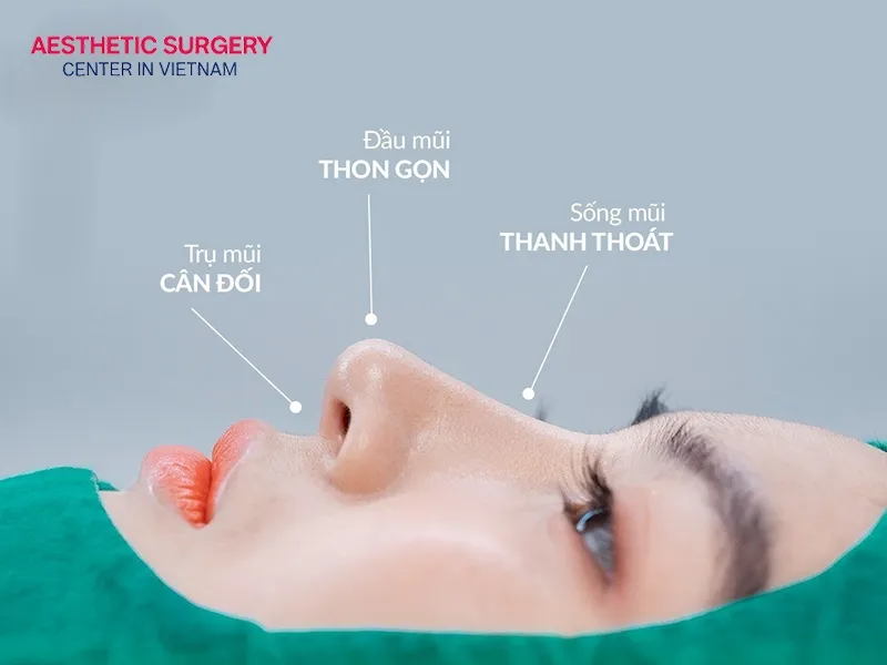 The nose becomes most stable after 6 to 12 months.