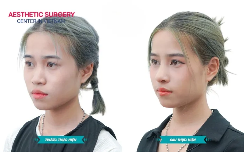 Balanced facial features are the key to greater confidence and success.