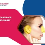Ear Cartilage Rhinoplasty