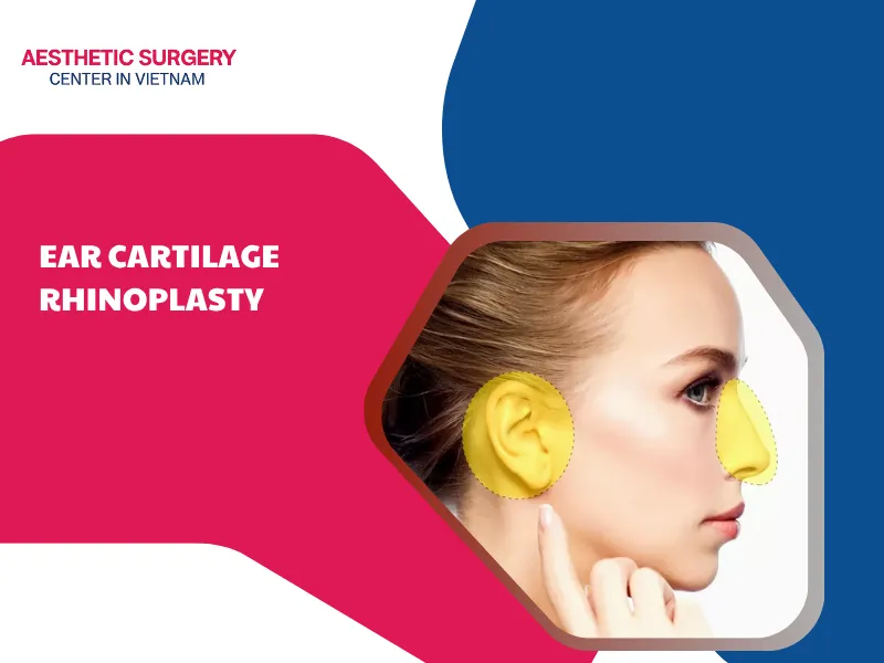 Ear Cartilage Rhinoplasty