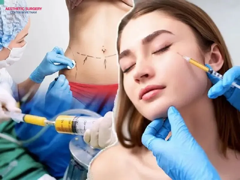 Facial fat grafting is a procedure that uses your own body fat, which is purified and then injected into sunken areas of the face.