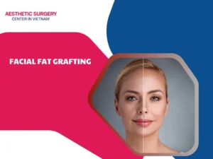 Facial Fat Grafting
