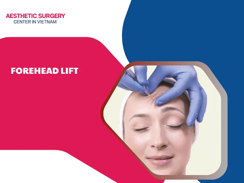 Forehead Lift