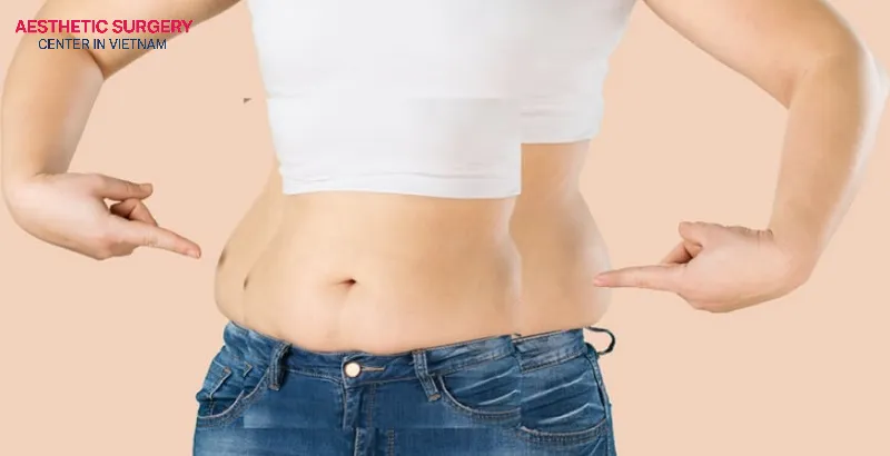 The more excess fat in the treatment area, the higher the cost.