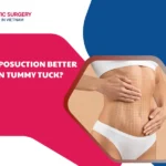Is liposuction better than a tummy tuck