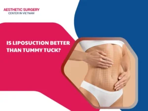 Is liposuction better than a tummy tuck