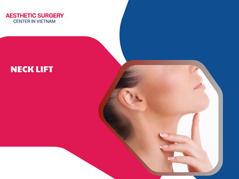 Neck Lift