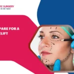 Prepare for a Facelift