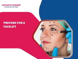 Prepare for a Facelift